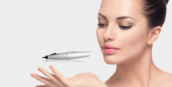 CryoPen Cryotherapy Luton