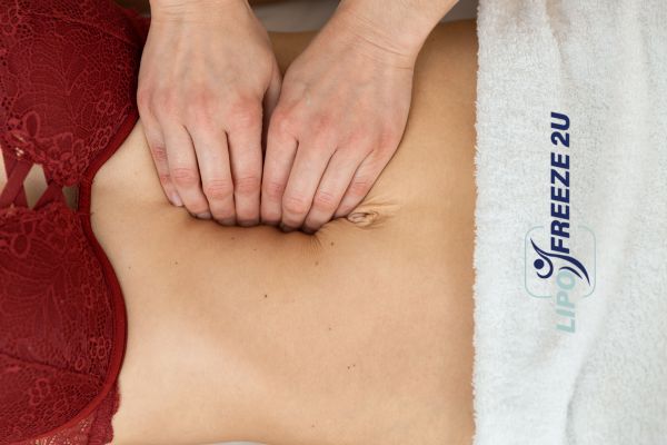 diastasis recti treatment Luton