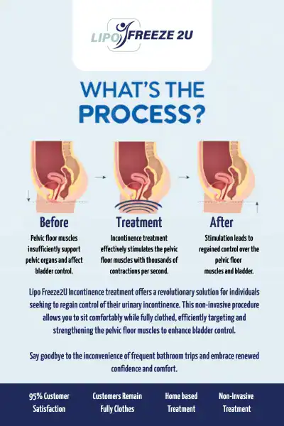 Diagram of how incontinence treatment Luton works.