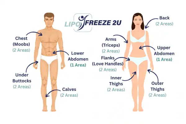 Areas you can have fat freezing treatment Luton