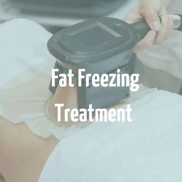 fat freezing treatment Luton