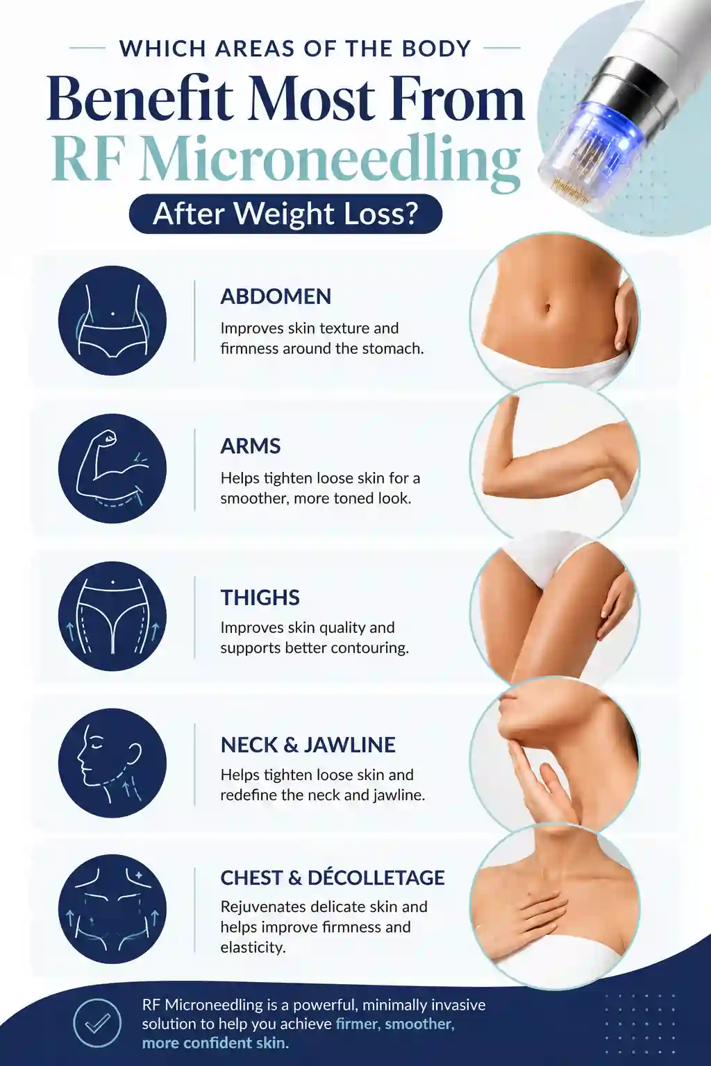 Which Areas of the Body Benefit Most From RF Microneedling After Weight Loss Luton